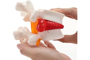 RONTEN wirbelsäule anatomisches modell, Bandscheibenvorfallmodell, menschliches anatomisches Lendenwirbelsäulenmodell für medizinisches Lehren