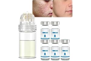 QKLOVNI Mikro-Infusionssystem für Lippen, Mikrosystem für Gesicht, Gesichtsbehandlung mit Serum, PockmarksHeal Mikronadel-Roller mit Hyaluronsäure, Serum für glatte Haut, 5er-Set