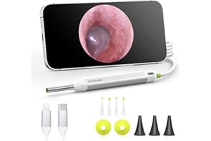 AnyScope HD Digital Otoscope, Video Ear Scope Otoscope with Light, Ultra Clear View Ear Camera with Ear Wax Removal Tools, Compatible with iPhone and Android Devices (Silver) ﻿