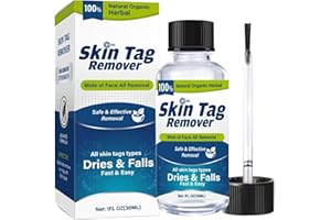 MEMONOTRY Skin Tag Removal Serum, Fast-Acting & Painless Skin Tag Remover Tag and Warts Dry & Fall Away Quickly, Natural and Safe