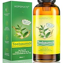 Hilfe Feigwarzen: Was HPV und FEIGWARZEN gemeinsam haben und wie ich es  erfolgreich behandelt habe : Kunz, Isabel, Kunz, Markus: Amazon.de: Bcher