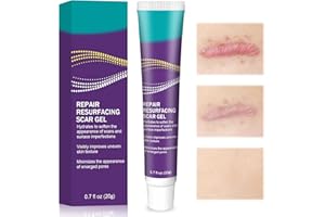 QULLMARTLE 20g Scar Cream, Scar Removal Cream, Effectively Reduce Scars, Gentle Care for The Skin, Suitable for Old & New Scars