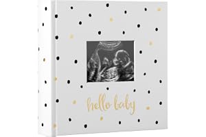 Pearhead Baby fotoalbum, babybok minnessak för nya och förväntande föräldrar, könsneutralt babytillbehör, svart och guld prickig