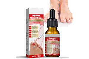 CHICNANA Ingrown Toenail Treatment, Ingrowing Toenail Treatment,Nail Growth Treatment,Natural Ingrown Toenail Correction, Nail Treatments, Trimming Toenail Softening Drops, Toe Nail Fungal Treatment（10ml）