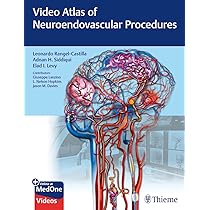 健康・医学 Decision Making in Neurovascular Disease Decision Making in Neurovascular Disease: 9781684200573