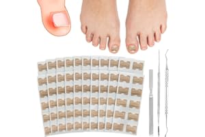 220 Pcs Toenail Stick Patch with 3 Pcs Ingrowing Toenail Kits, SPOKKI Glue-free Ingrown Toenail Corrector Sets, Painless Ingrown Toenail Treatment Foot Tool for Nails Healthy & Relieve (White)
