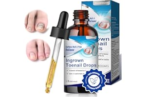 GELPRETTY 30ml Professionnel Soin D’ongle, Mycose de l'ongle,Pour Les Ongles Décolorés Épaissis,Contre la Mycose de l'ongle Persistante, Application Facile, aisse le Pied et la Main Saine