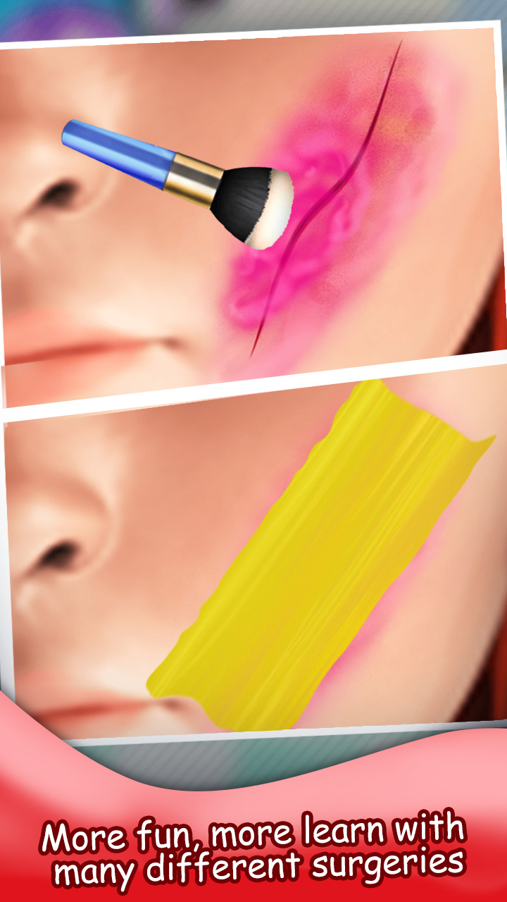Eye Eye