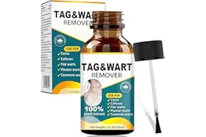 YOLONCE 30ml Skin Tag Remover, Soluzione per la Cura della Pelle, Facile e rapido, Adatto a Mani e Piedi