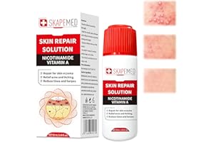 HALERCAY 50ml Crème de l'eczéma,Crème hydratante,Soin apaisant Cream,Hydrate Lotion,Soulage et Apaise pour les peaux sèches,Utilisable sur différentes parties du corps