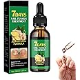 Ginger Nail Treatment Nail Support Nail Care, 7 Days Nail Treatment,Ginger Nail Growth Serum, Ginger Nail Treatment, Ginger Cuticle Care Oil for Damaged Nails (1pcs, 30ml)