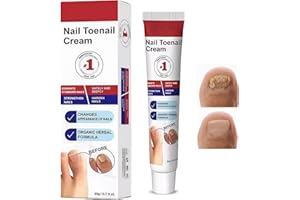 YAGASPANTERY 20g Crema per Riparazione Unghie, Cura Unghie Piedi, Soluzione per La Cura Delle Unghie, Rinforzante Unghie, Nail Repair per Restores Appearance of Discolored or Damaged Nails