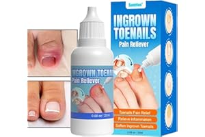 Gocce per unghia incarnita | Soluzione per la riparazione delle unghie Correttore Ammorbidente per unghie dei piedi - Gocce professionali per unghie incarnite per unghie spesse e scolorite Thaely