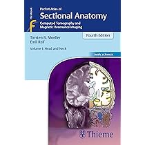 Buy Pocket Atlas of Sectional Anatomy: Head and Neck - Computed