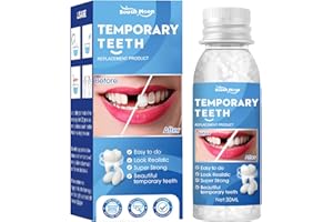 Guegine Tooth Filling Repair Kit Tooth DIY Moldablefake Teeth Beads for Temporary Fixing Tooth Filling Repair kit Temporary Tooth Fillingdental Repair Kit Temporary Tooth