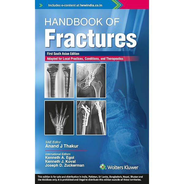 Buy Handbook of Fractures Book Online at Low Prices in India