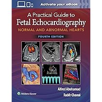 Buy A Practical Guide to Fetal Echocardiography: Normal and