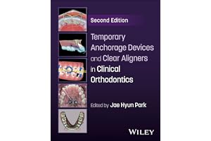Temporary Anchorage Devices and Clear Aligners in Clinical Orthodontics