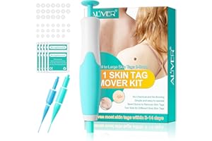 FIND BACK Skin Tag Entferner, Auto Skin Tag-remover Kit, 2-in-1Stielwarzen Entfernen schnell Kit, Skin Tag Removal Patch Sicher und Schmerzfrei, 2-8 mm Bänder mit 40 Tag Bands, grün