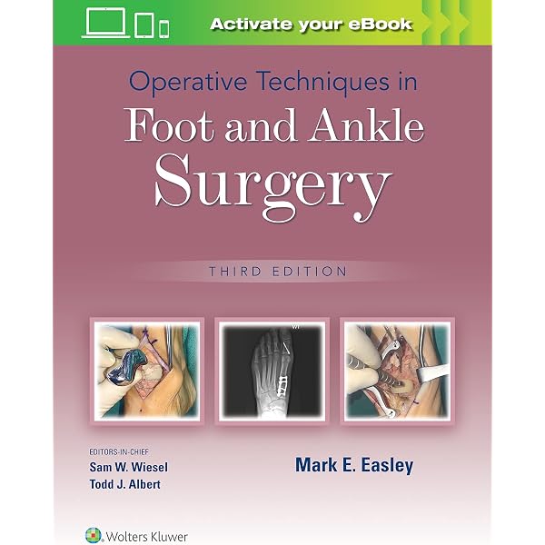Buy Coughlin and Mann's Surgery of the Foot and Ankle, 2-Volume