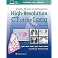 Webb, Müller and Naidich's High-Resolution CT of the Lung