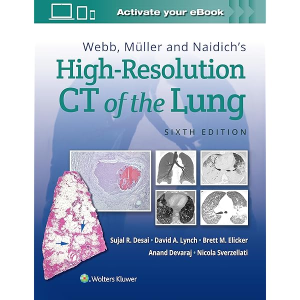 Buy HIGH RESOLUTION CT OF THE LUNG 5ED (HB 2015) Book Online