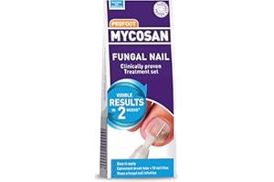 Profoot Mycosan Fungal Nail Treatment - 5ml Unique Serum Treatment for Toenail Infection - Includes Specially Designed Brush, 10 Single-Use Nail Files & Treatment Schedule - Nail Fungus Treatment