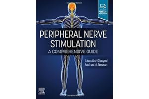 Peripheral Nerve Stimulation: A Comprehensive Guide