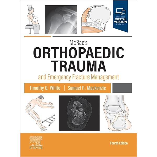 Handbook of fractures, 1st South Asian ed eBook : Anand J