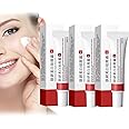 Whitening Freckle Cream,Melasma Treatment For Face,Pigmentation Removal Cream For Face,Moisturizing Removes Facial Melasma Dark Spots Wrinkles Blemishes,Acne Scar Removal Treatment Cream 20g (3pcs)