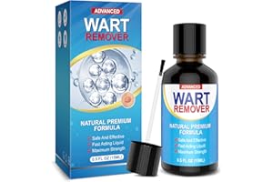 Suuprone Wart Remover, Stem Warts Remover, Corns Remover, Thorn Warts Removal Foot, Natural Herbal Extracts, Gentle Warts Removal, Painless and Scar-free 15 ml