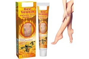 TONISABERY Varic/ose Ve/ins Treatment for Legs,Natural Varic/ose Ve/ins Cream,Varic/ose Ve/ins Treatment Cream,Cream for Varic/ose Ve/ins in Legs,SPI/der V/eins Repair Cream,Varic/ose Ve/ins Relief Cream