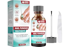 RUNADI Micosi Unghie Piede, Trattamento per la micosi delle unghie dei piedi, 30 ML, Blu, Liquido