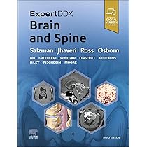 ExpertDDx: Brain and Spine : Salzman MD FACR, Karen L., Jhaveri MD