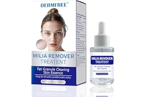 TULAMORIY 30ml Solución Exfoliante Facial,Líquido exfoliante suave para el Rostro,Loción para el Cuidado facial,Ayuda a Limpiar y Refinar los Piel,Ideal Usar en Rutina de Cuida tu Piel Diaria