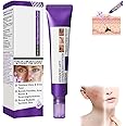 Ceoerty Epiglow MelanEX Advanced Anti-Hyperpigmentation Cream,Epiglow Melanex Cream,Hyperpigmentation Treatment,Dark Spot Remover for Face and Body (1 Pcs, 20g)