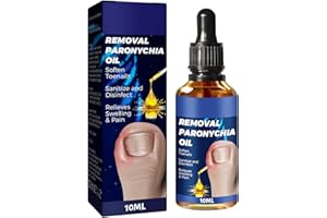 CHICNANA Ingrown Toenail Treatment, Ingrowing Toenail Treatment,Nail Growth Treatment,Natural Ingrown Toenail Correction, Nail Treatments, Trimming Toenail Softening Drops, Toe Nail Fungal Treatment-10ml