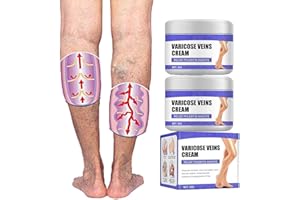 VINXAN Vein Care Fading Cream,Veins Herbal Ointment,Anti Varicose Vein Soothing Leg Cream, Improve Blood Circulation,Eliminate Varicose Veins and Spider Veins,Relieve Pain of Legs (2 Pcs)