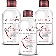 Caladryl Skin Allergy Expert Lotion for relief from skin rashes, sunburn, prickly heat, insect bites - Pack of 3 (3 x 65 ml)