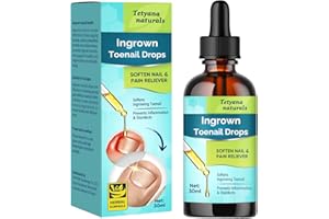 Memonotry Ingrown Toenail Treatment, Ingrown Toenail Kit for Soften Ingrown Toenail & Relieve Ingrown Toenail Pain, Natural & Effective Ingrown Toenail Corrector Drops, 30ml