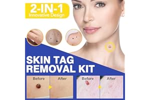 IDUCEN Haut-Tag-Entferner-Set, 2-in-1-Mikro-Hautmarken-Entferner für kleine bis mittlere Hautmarken, sicher und schmerzlos für die meisten Körperteile
