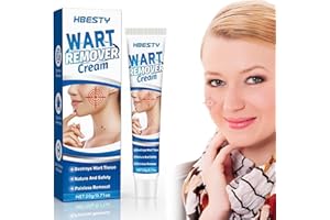 HBESTY Wart Removal Cream 20g, Skin Tag Removal, Effective Treatment of Warts, Corns Spot Moles, Moles and Calluses, Wart Remover Cream for Face, Body and Hands