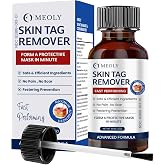 MEOLY Fast-Acting Skin Tag Remover: Skin Tag Remover with Salicylic Acid for Men and Women 0.9 oz