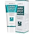 Dark Spot Remover for Face and Body, Dark Spot Corrector, Age Dark Spot Remover for Women Men, Evens and Fades Spots with Effective Formula, Hyperpigmentation, Sunspots, Melasma Treatment for Face