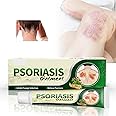Psoriasis Ointment, Psoriasis Cream Eczema Cream, 20 Grams of fungal antipruritic Cream for Urticaria, Skin Allergy, Tinea of Hands and Feet, Foot Odor, Foot itching, Tinea Corporis, Etc