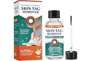 ATUIO Skin Tag Remôvàl, Fast-Acting & Painless Skin Tag Remover,Wart & Mole Fall Away Quickly