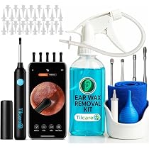 Siringa Auricolare Per Pulizia Orecchie 206ml - Kit Lavaggio Cerume, Morbida, Riutilizzabile, Sicura Per Bambini E Adulti, Multiuso