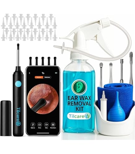 Reyova Oreille, Endoscope Nettoyant Oreille Kit Avec 6 Lumières Led, Otoscope Oreille 1080p Hd, Pour Ios and Android, Pour Adultes, Enfants (Noir