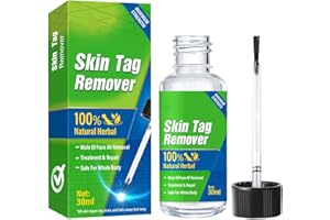 YEEGFEY Skin Tag Removal, Natural & Gentle Skin Tag Remover Serum, Tag Dry & Fall Away Naturally, Painless & Effective, Suitable for All Skin Types