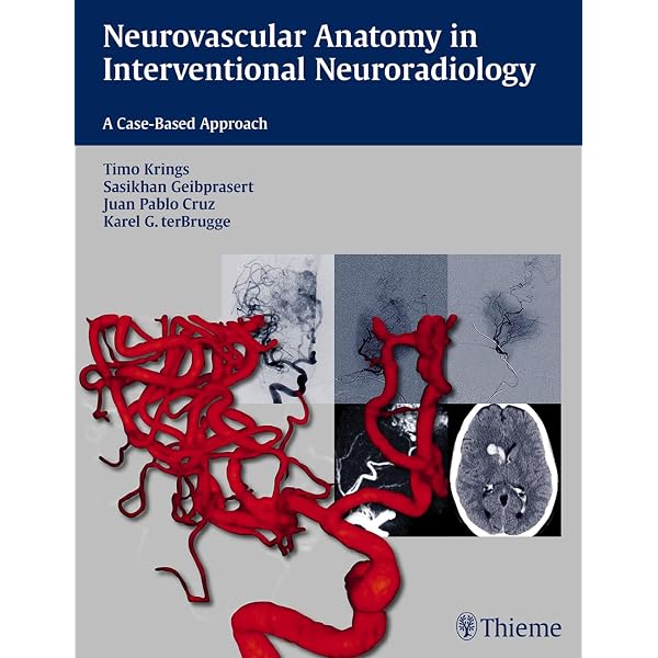 Buy Decision Making in Neurovascular Disease Book Online at Low